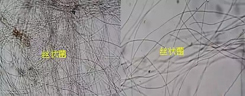 又到污泥換季膨脹的季節!你的污泥還好嗎?